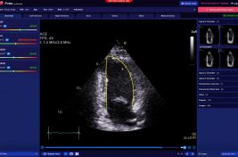 heartlab-pulse-image