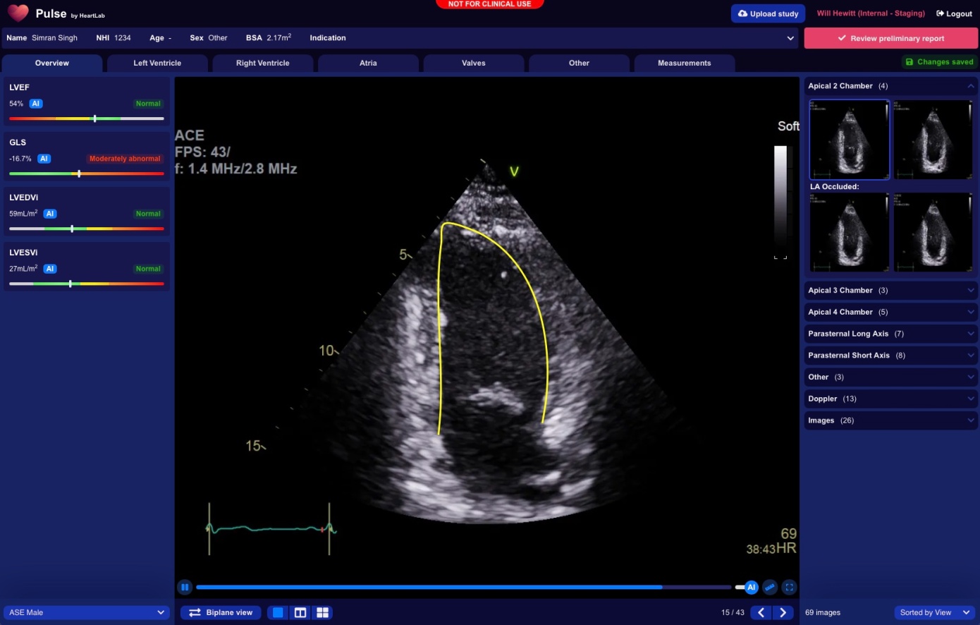 heartlab-pulse-image